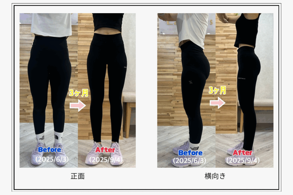 ピラティスを３ヶ月続けた女性の脚のビフォーアフター