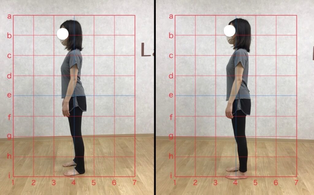 1回の体験レッスンでの実際のBefore／After写真